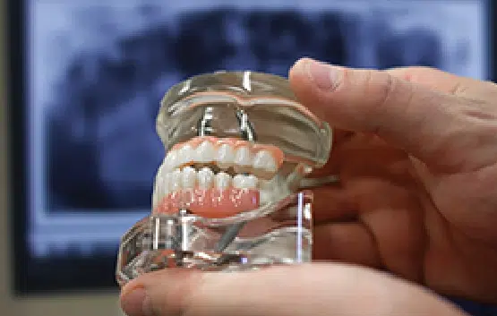 dental implant patient quiz