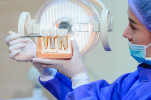 Read more about the article What Are the Common Types of Dental Implants?