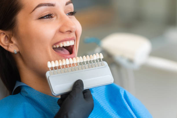 Read more about the article How to Choose the Right Type of Dental Implant for You