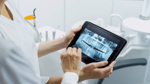 Read more about the article The Role of Technology in Modern Dental Implants