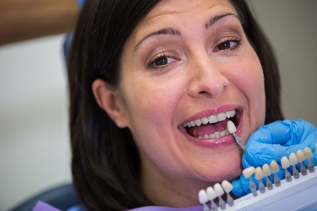 You are currently viewing Why Patients Choose TruSmile for Dental Implants in Chula Vista & San Diego