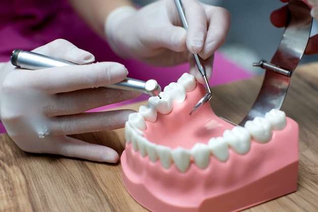 You are currently viewing Can You Replace Multiple Missing Teeth with Implant Bridges? Here’s What You Should Know